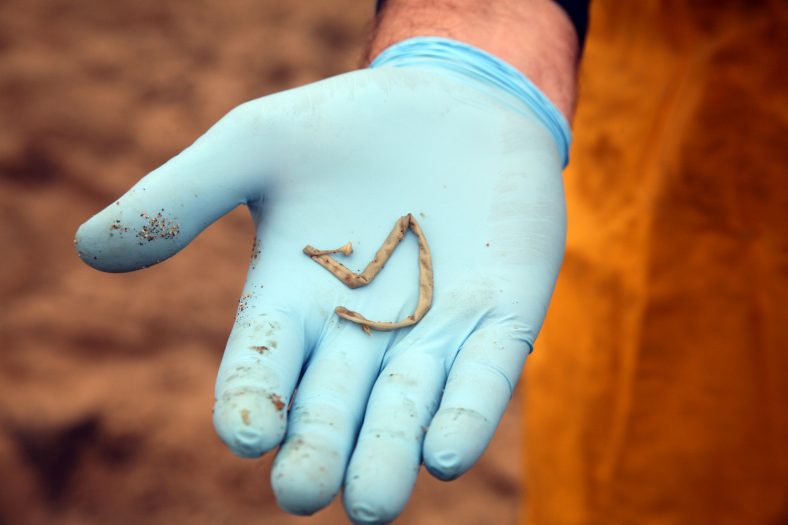 Tapeworm Diet Weight Loss, Risks and Side Effects 2024 Guide Sta.ME