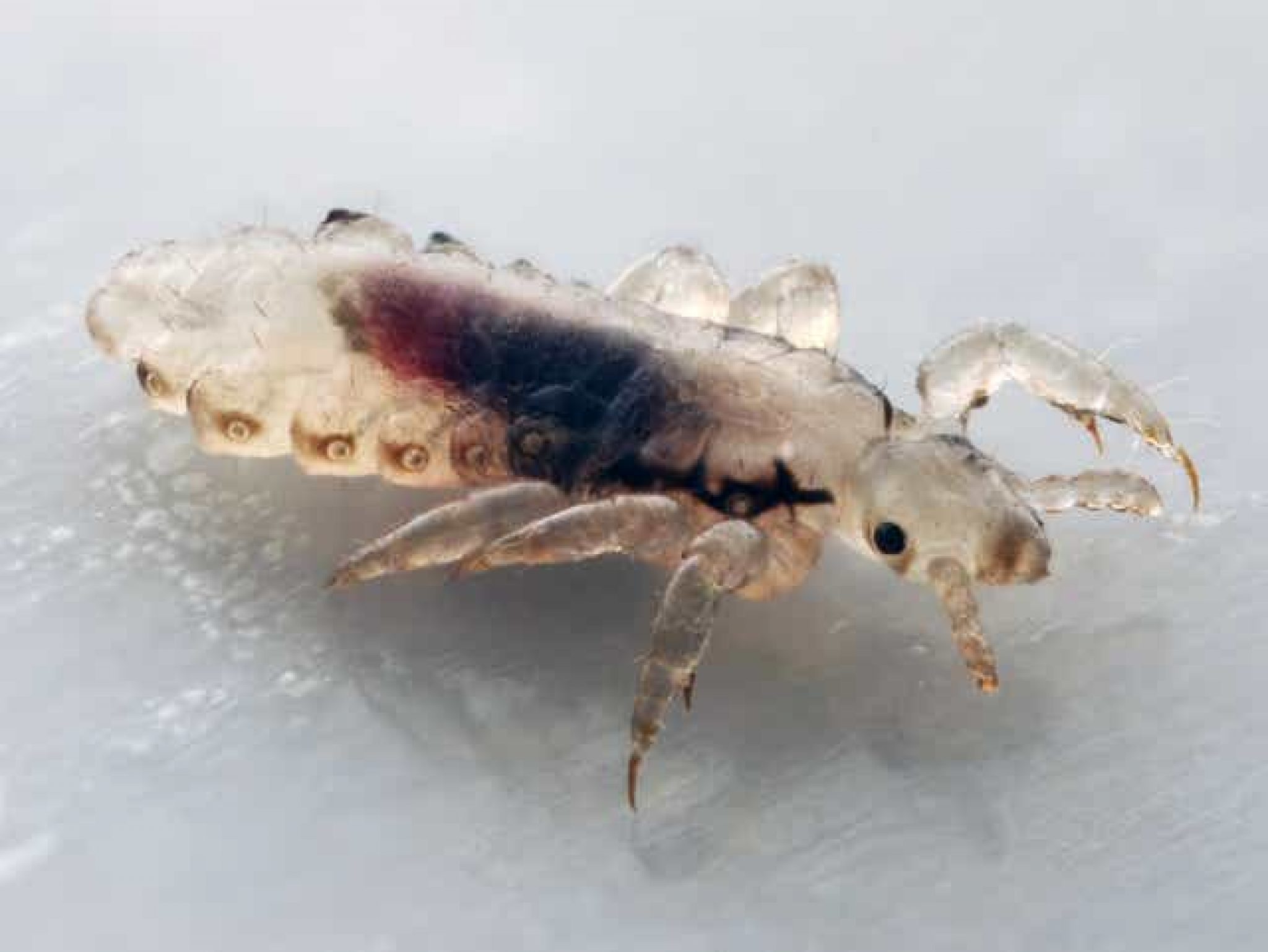 All Kinds Of Essential Details About The Super Lice Treatment WebSta.ME