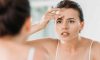 7 Tips and Tricks for Preventing Forehead Acne and Pimples