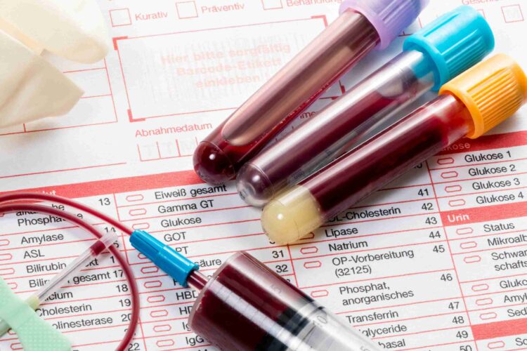 Clinical Trials and Blood Test Advancements