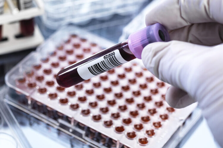Success Stories in Blood Test Commercialization