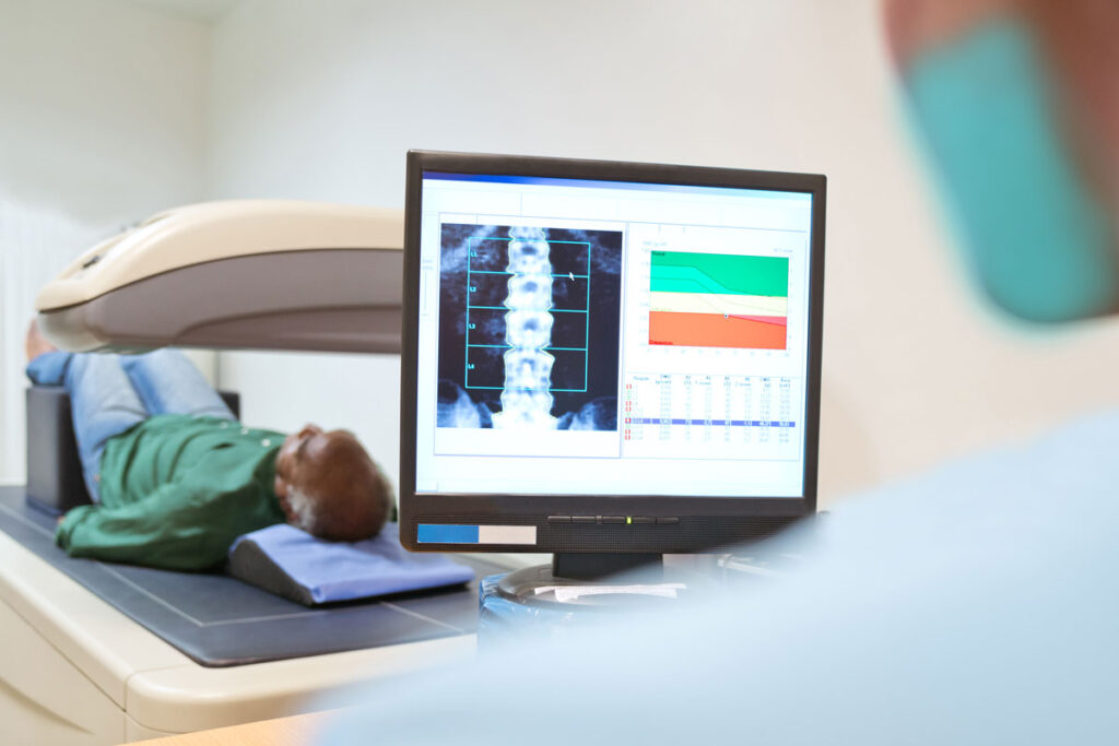 bone density testing