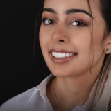 Full Set of Veneers Cost