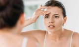 7 Tips and Tricks for Preventing Forehead Acne and Pimples
