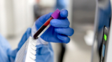 A Look at Montreal’s Leading Blood Test Research