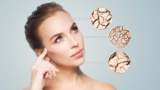 3 Types of STDs that Cause Dry Skin – A Detailed Guide 2024