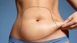 Eliminating Fat-Related Issues and Enhancing Skin Health With Lipo Lab Products