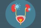 What Causes Unitary Tract Infection and How to Avoid It – 2024 Guide