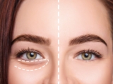 The Impact Of Sleep & Stress On Dark Circles