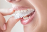 How Long Does It Take To Get Comfortable With Invisalign?
