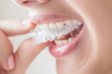 How Long Does It Take To Get Comfortable With Invisalign?