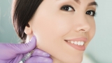 7 Things you Need to Know About Jawline Fillers