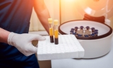 What is Platelet-Rich Plasma Therapy?