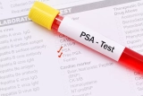 Your Guide to PSA Testing
