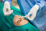 How Long Does It Take To Recover After Septoplasty Surgery? – 2024 Guide
