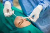 How Long Does It Take To Recover After Septoplasty Surgery? – 2024 Guide