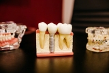 A Guide to Selecting the Right Tools and Software for Your Dental Office – 2024